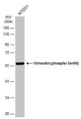 Western Blot: Vimentin [p Ser56] Antibody [NBP3-13119] - Whole cell extract (30 ug) was separated by 10% SDS-PAGE, and the membrane was blotted with Vimentin (phospho Ser56) antibody (NBP3-13119) diluted at 1:1000. The HRP-conjugated anti-rabbit IgG antibody (NBP2-19301) was used to detect the primary antibody.